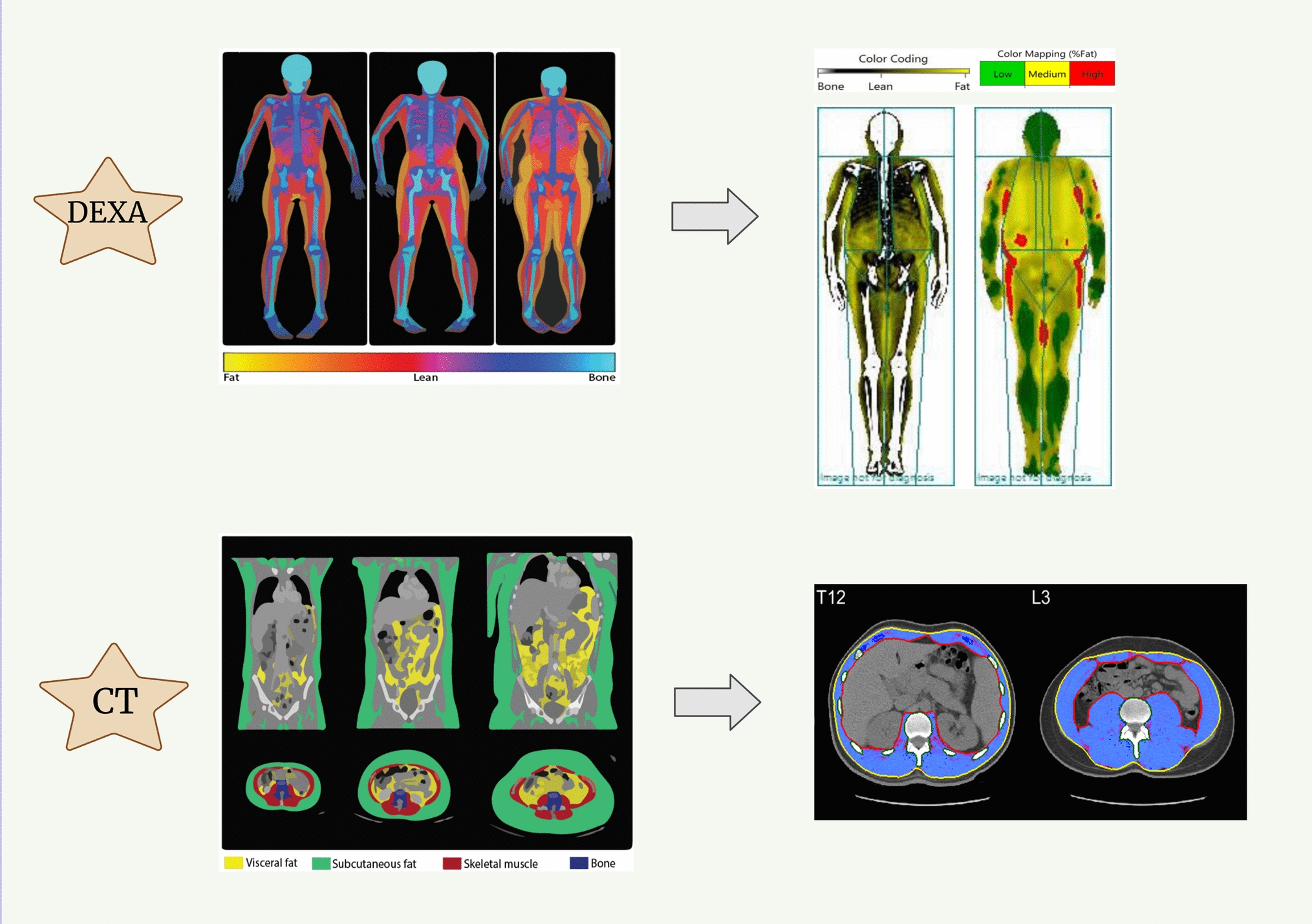 Utilizing Opportunistic Computed Tomography Imaging to Refine Lean Body Weight Estimates in Patients with Obesity