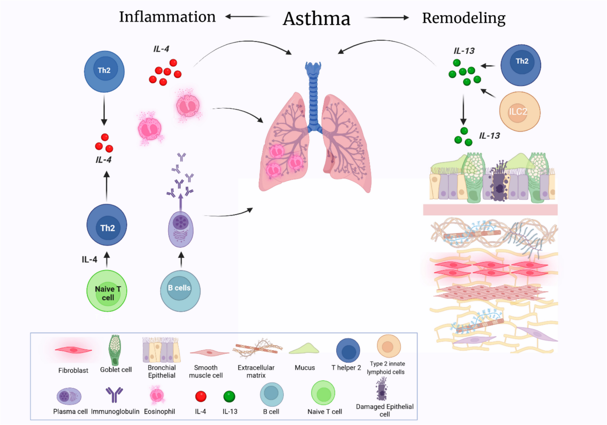 Targeting IL-13 and IL-4 in Asthma: Therapeutic Implications on Airway Remodeling in Severe Asthma