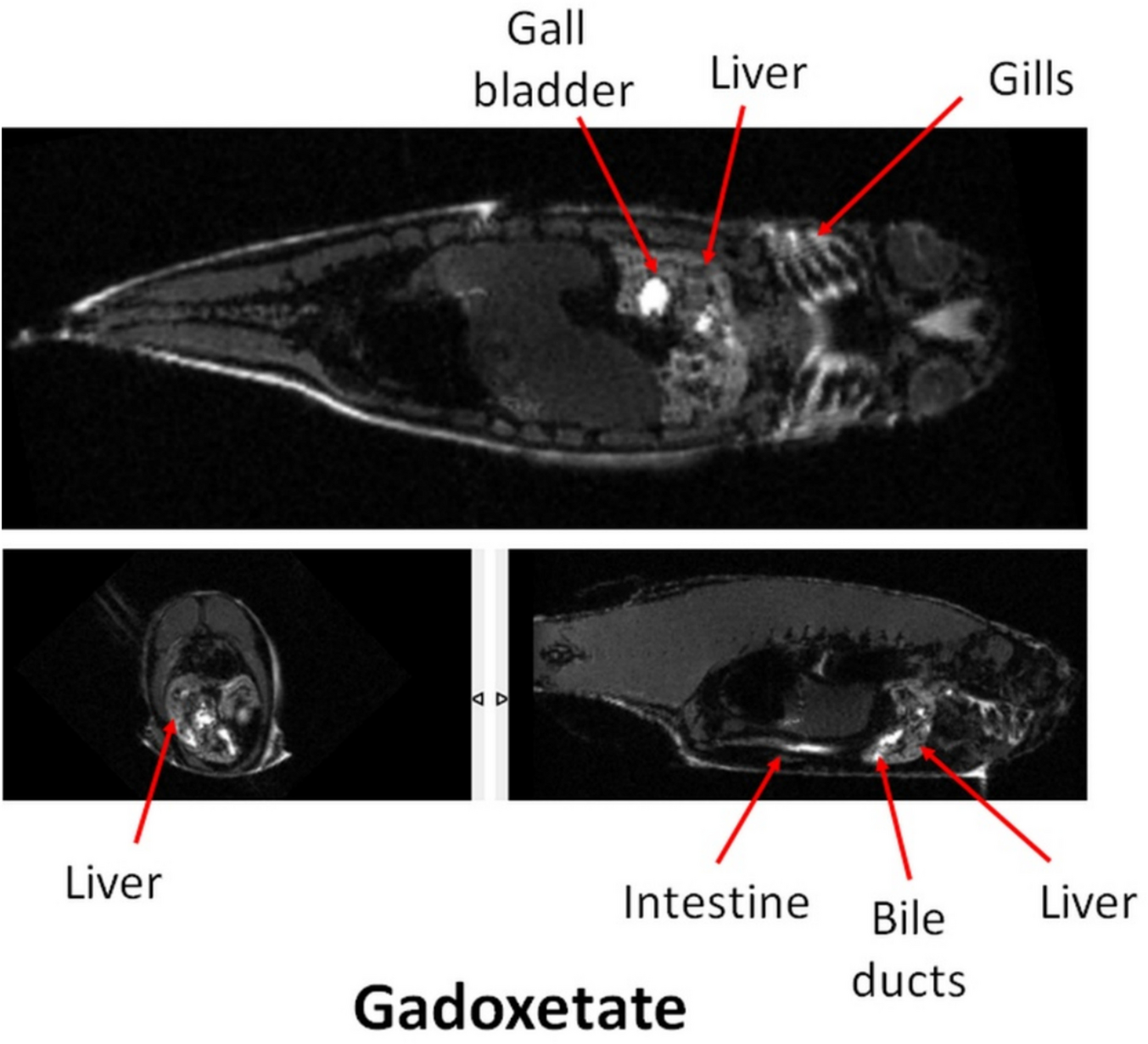 Go Fish! Hepatic Uptake of Clinical Hepatospecific Gadolinium-Based MRI Contrast Agents in Zebrafish is Similar to Humans