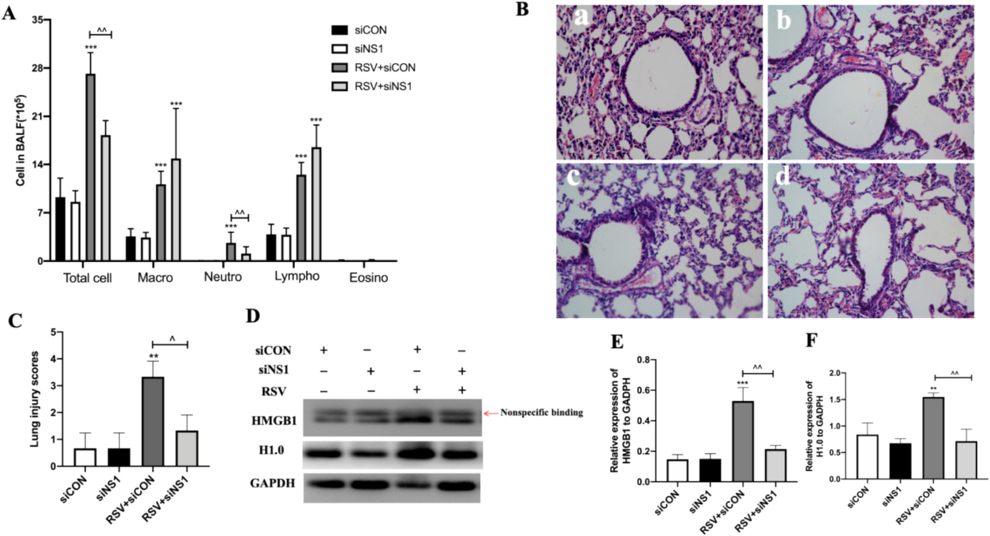 Nonstructural Protein 1 Mediates HMGB1 Release by Targeting Histone H1.0 After Respiratory Syncytial Virus Infection In Vivo and In Vitro
