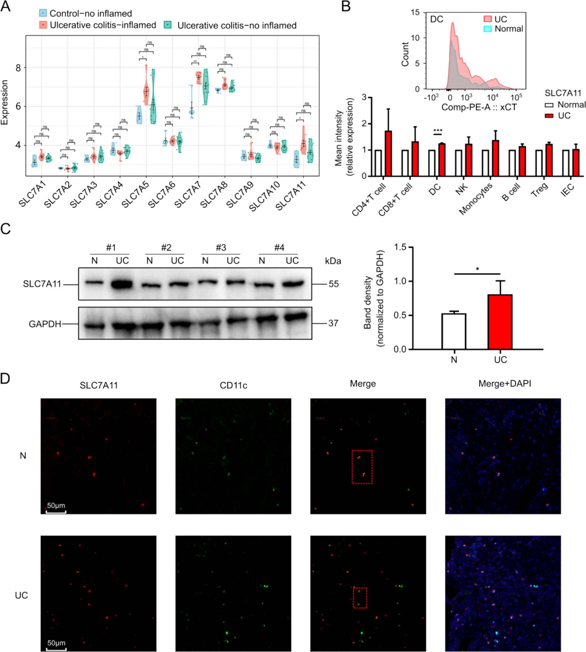 Targeting SLC7 A11 Ameliorates Ulcerative Colitis by Promoting Efferocytosis Through the ERK1/2 Pathway