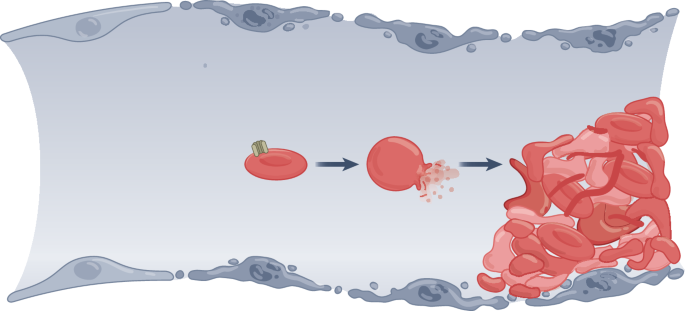 Endothelial cell necroptosis induces haemolysis and microangiopathy