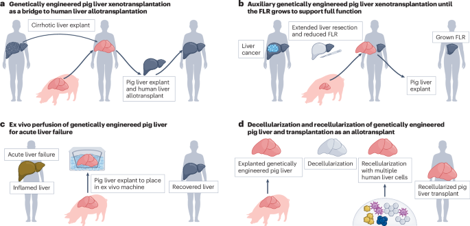 Promise and pitfalls of liver xenotransplantation