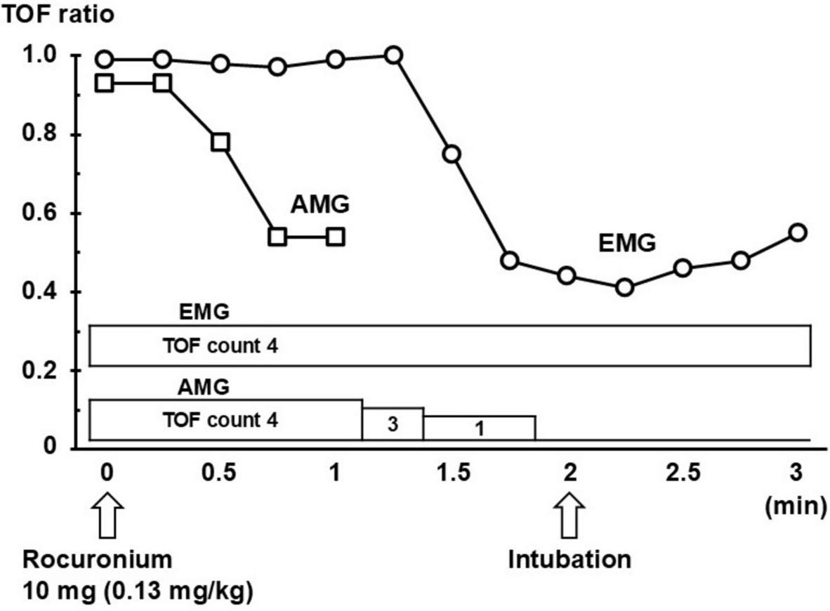 A patient with myasthenia gravis showing lower sensitivity to rocuronium and earlier recovery of train-of-four responses on electromyography compared to acceleromyography: a case report