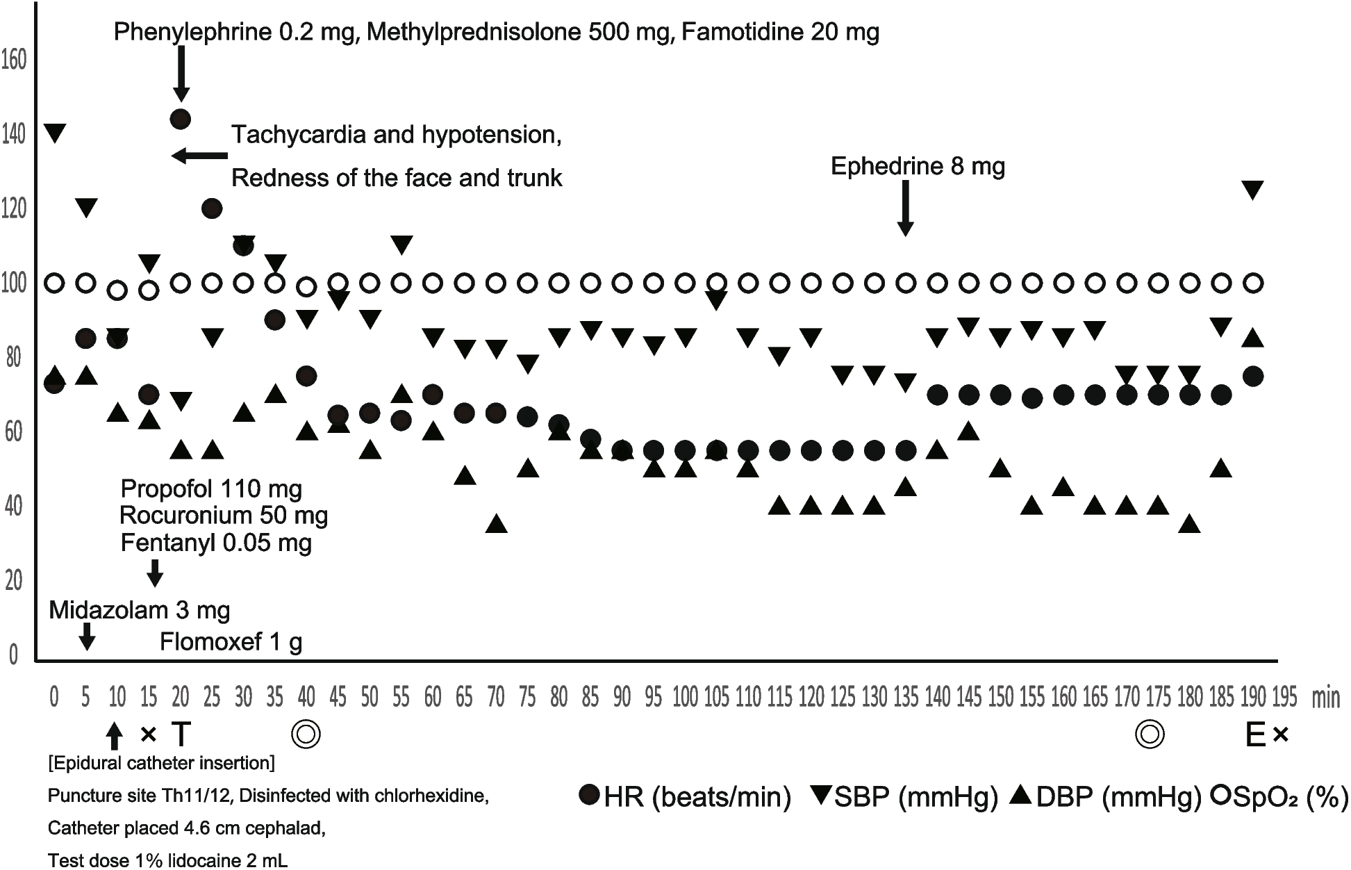 Anaphylaxis due to midazolam administered before induction of general anesthesia: a case report