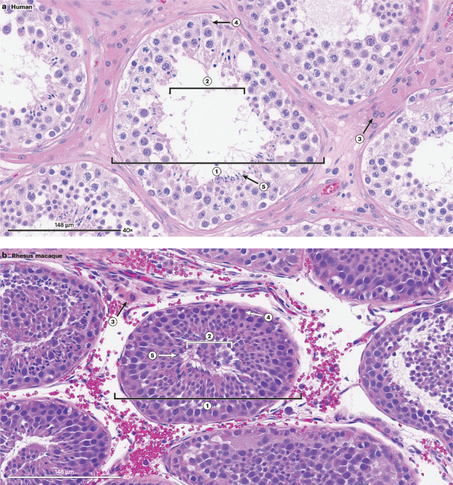Non-human primates as a translational model for the study of male reproductive health