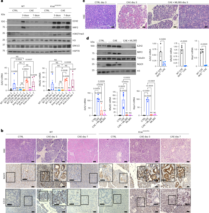 Self-amplifying NRF2–EZH2 epigenetic loop converts KRAS-initiated progenitors to invasive pancreatic cancer