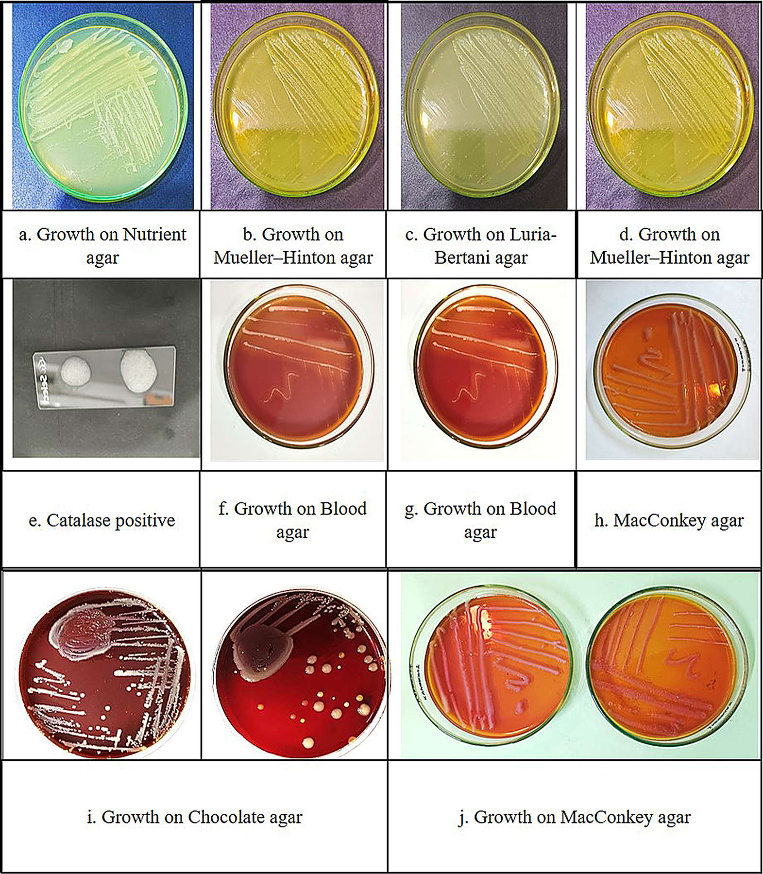 Whole-genome evaluation and prophages characterization associated with genome of carbapenem-resistant  UOL-KIMZ-24-2
