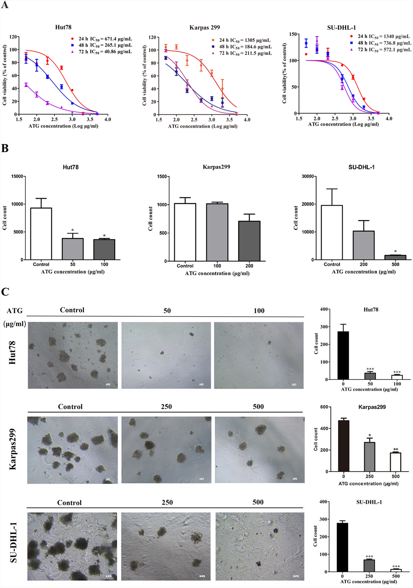 Antitumor effects of human antithymocyte globulin on peripheral T cell lymphoma via complement-dependent and -independent cytotoxicity in xenograft mouse models