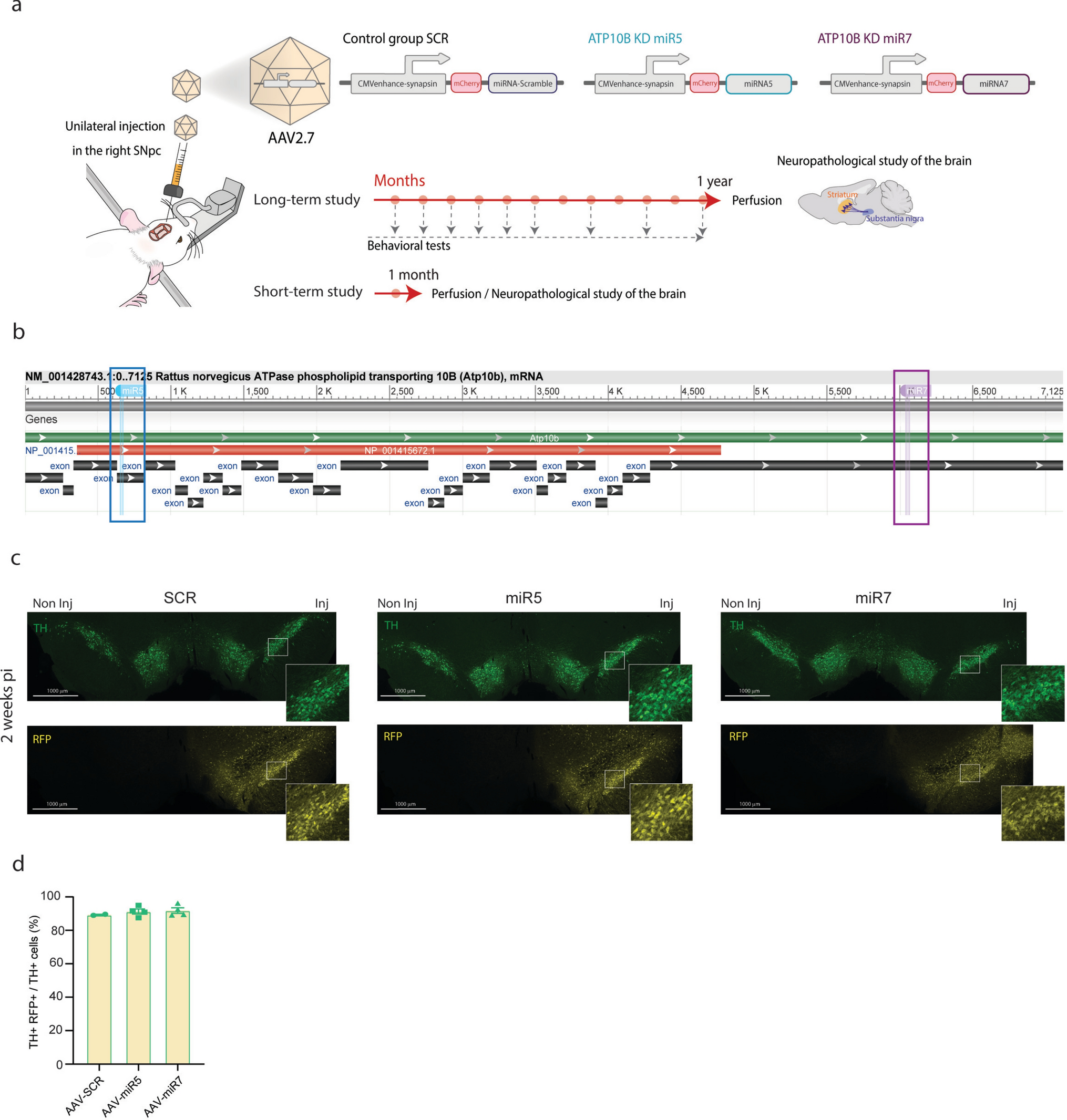 Loss of the lysosomal lipid flippase ATP10B leads to progressive dopaminergic neurodegeneration and parkinsonian motor deficits
