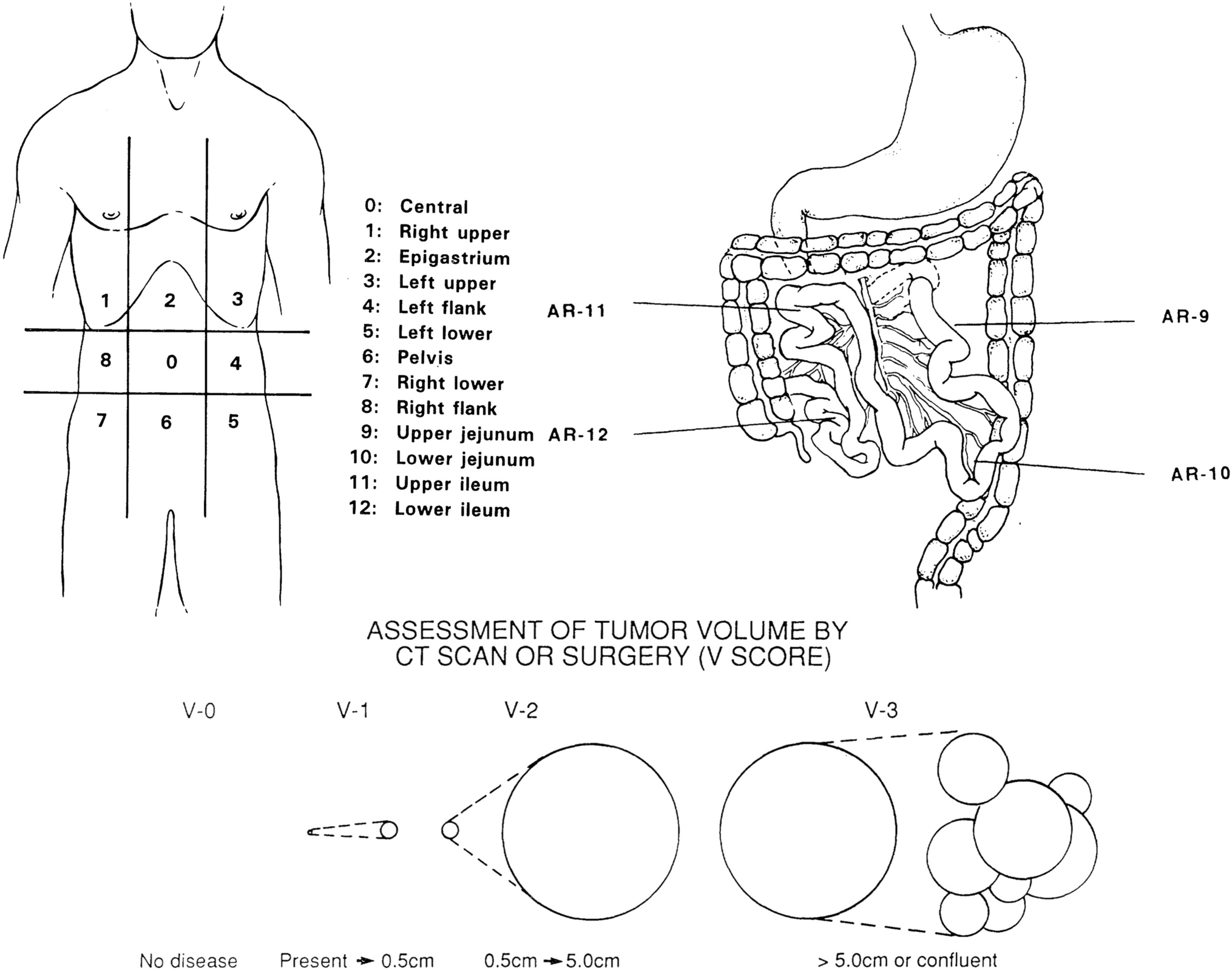 Asian consensus on normothermic intraperitoneal and systemic treatment for gastric cancer with peritoneal metastasis