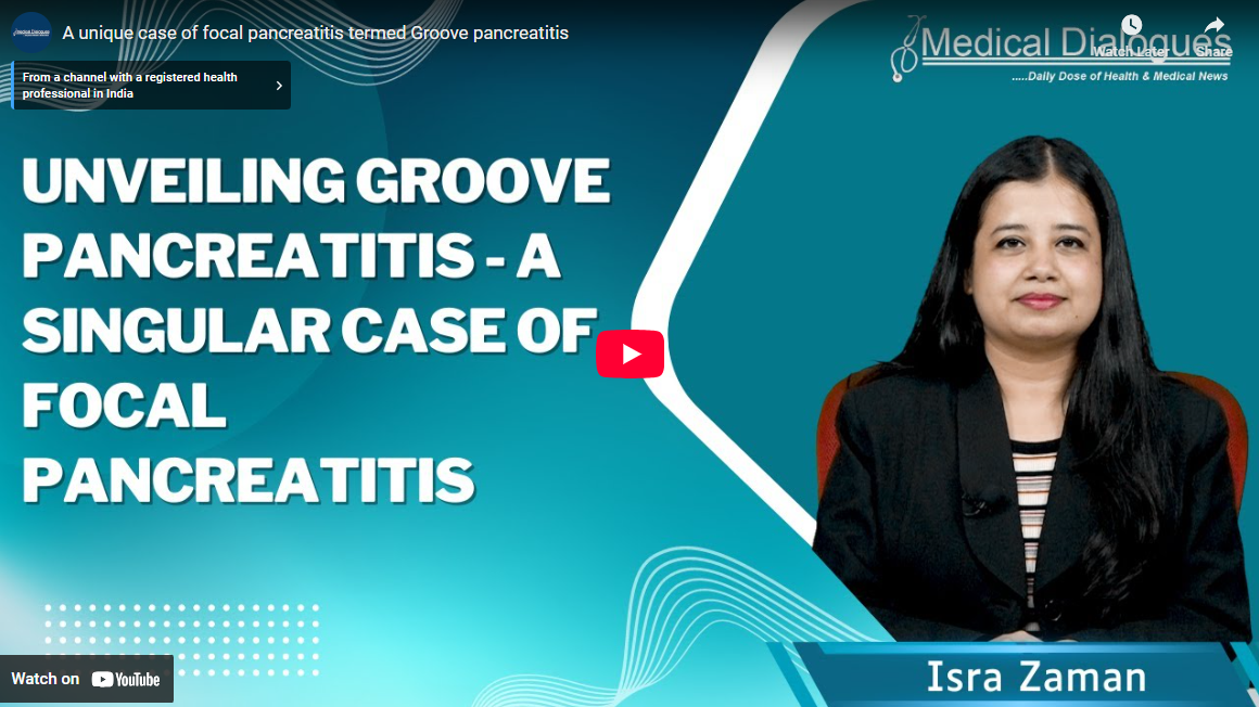 News covered by Medical Dialogues: A unique case of focal pancreatitis termed Groove pancreatitis