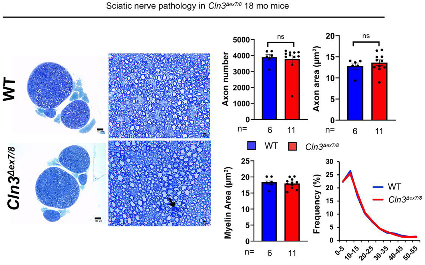 Gene therapy ameliorates neuromuscular pathology in CLN3 disease