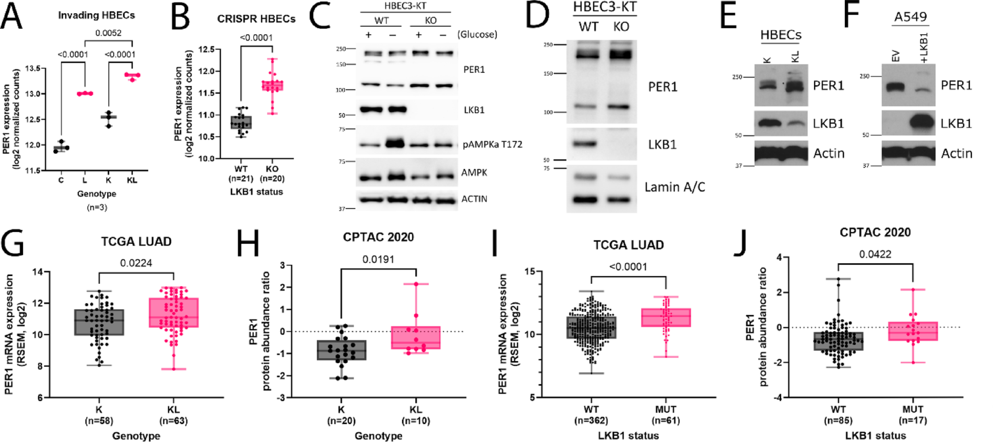 High PER1 expression is associated with  mutation and clinical biomarkers of immunotherapy resistance in lung adenocarcinoma