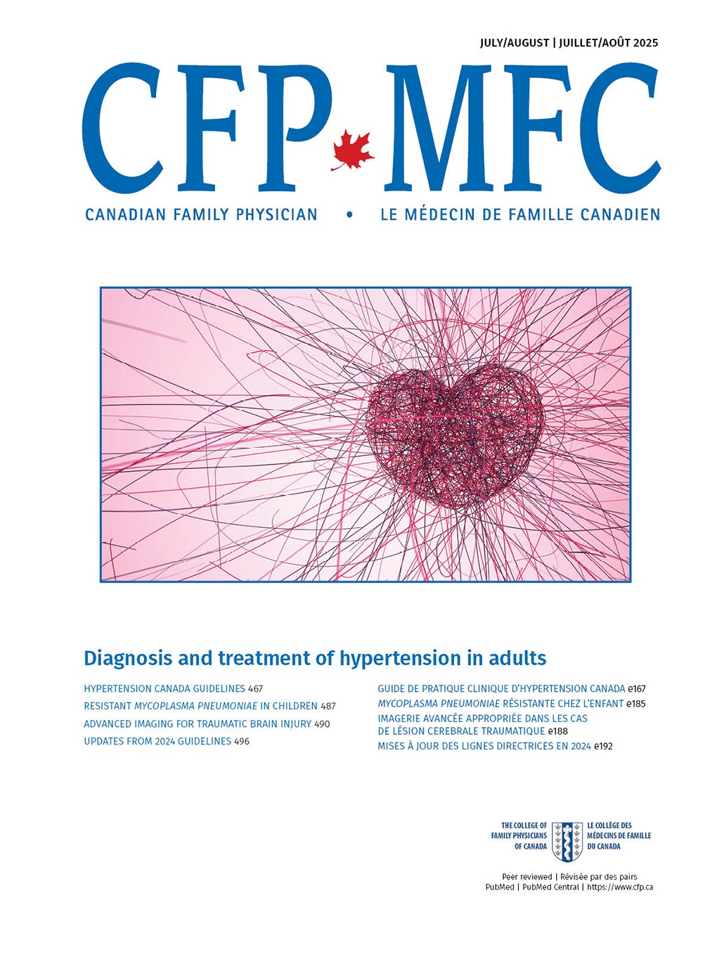 Tick-borne anaplasmosis: First known case in southwestern Ontario