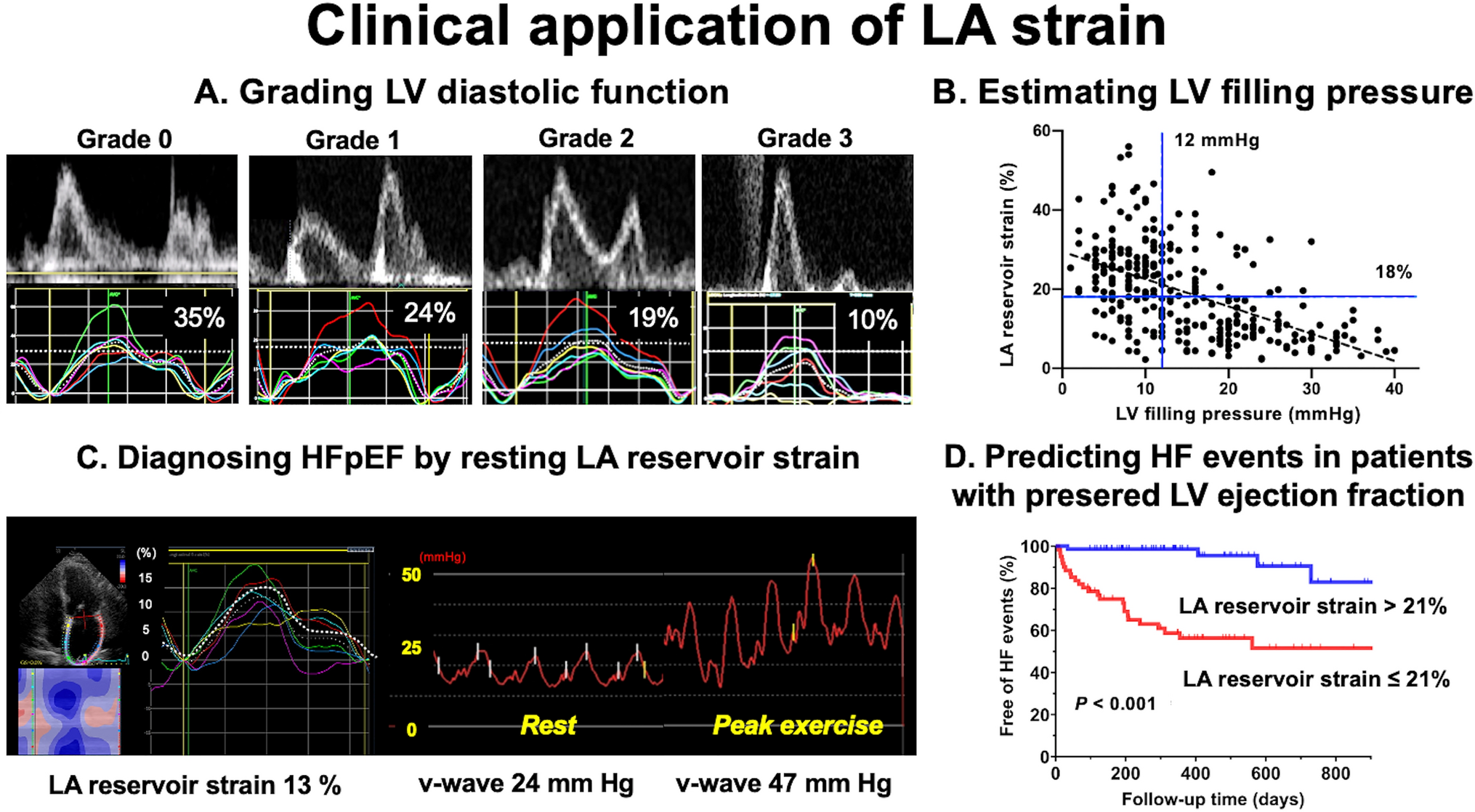 Clinical utility of the left atrial strain analysis