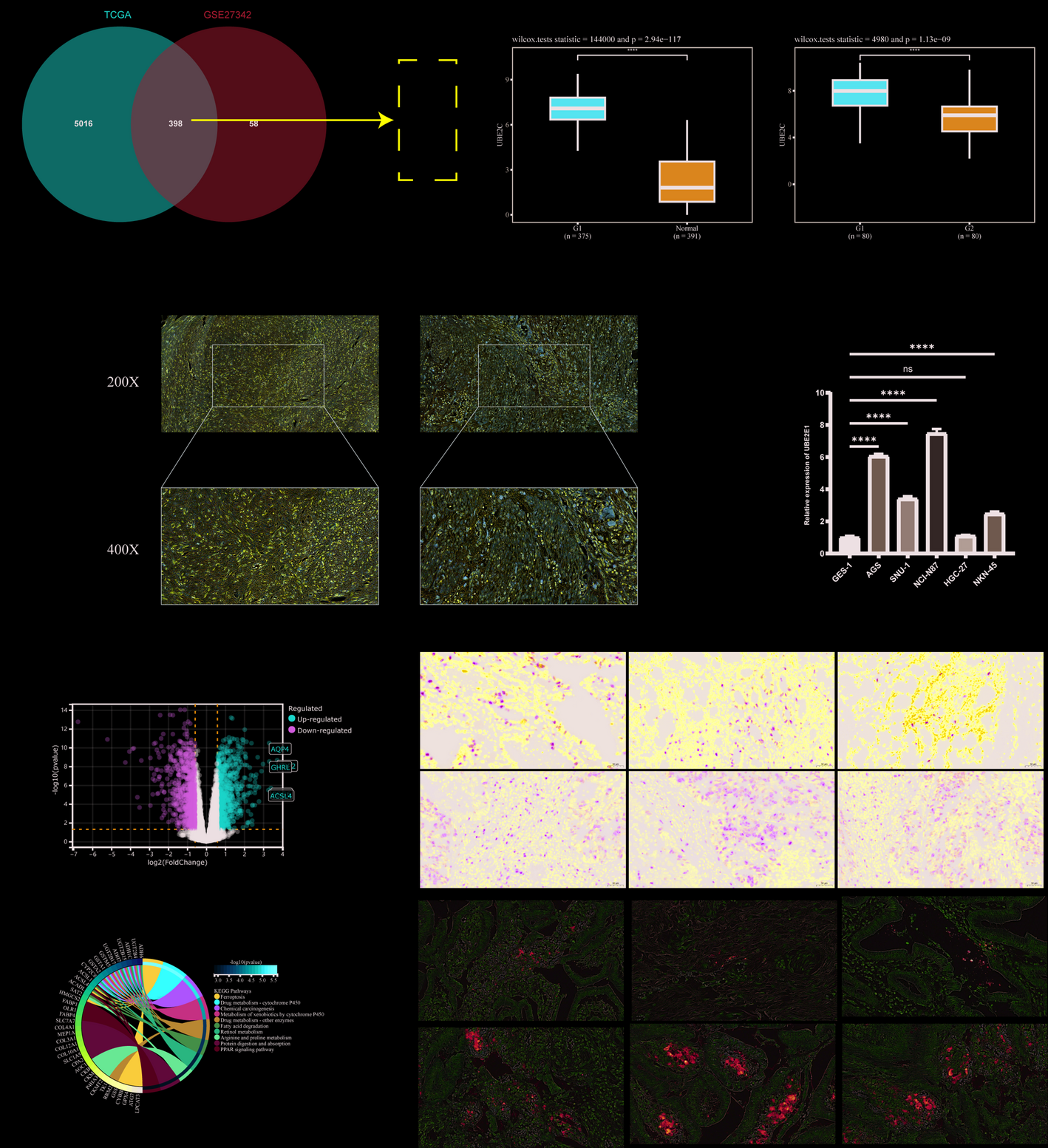 UBE2C-mediated ubiquitination of ACSL4 inhibits ferroptosis and promotes gastric cancer progression
