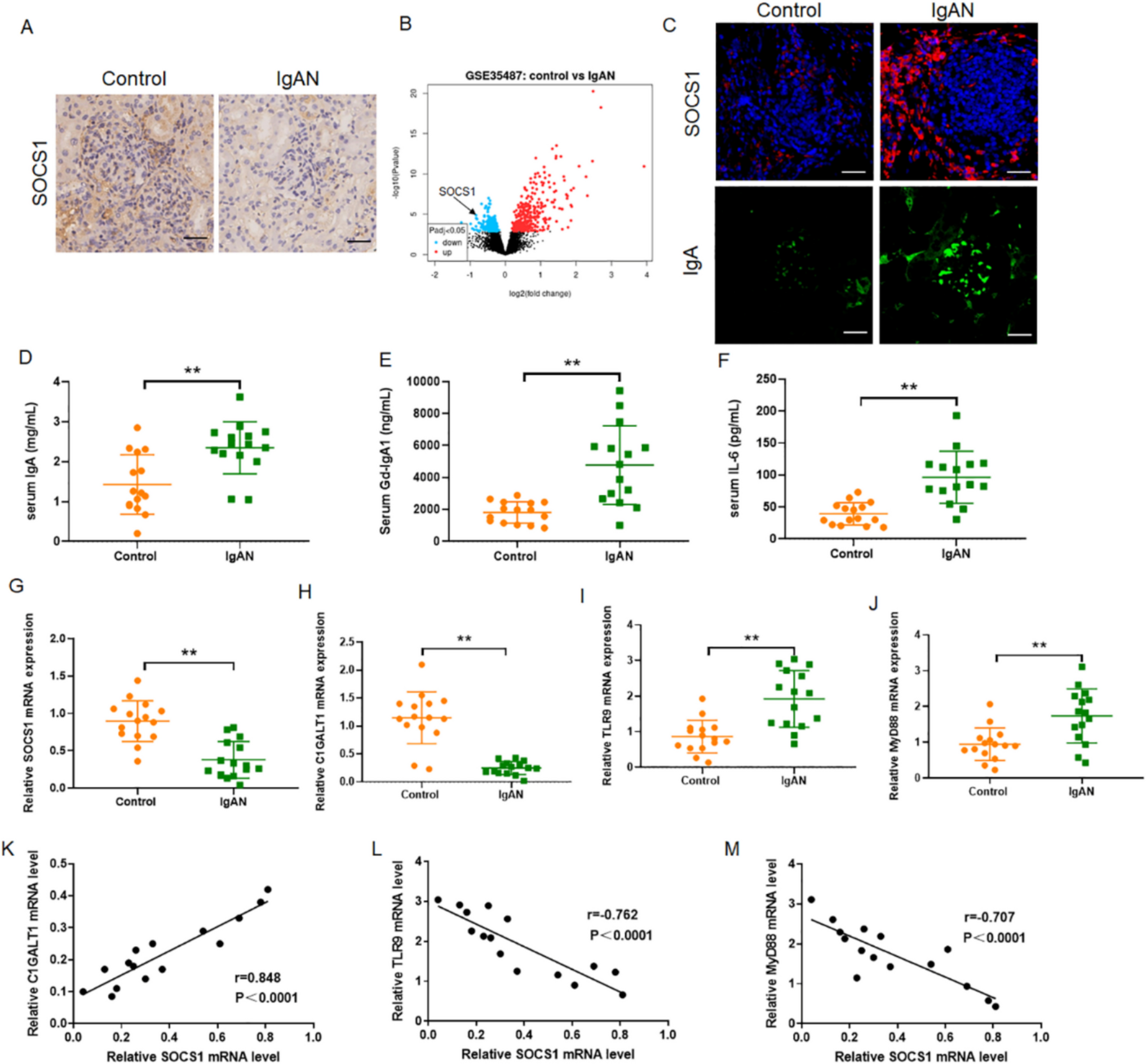 SOCS1 improves abnormal IgA galactosylation in IgA nephropathy by regulating the TLR9/MyD88 pathway