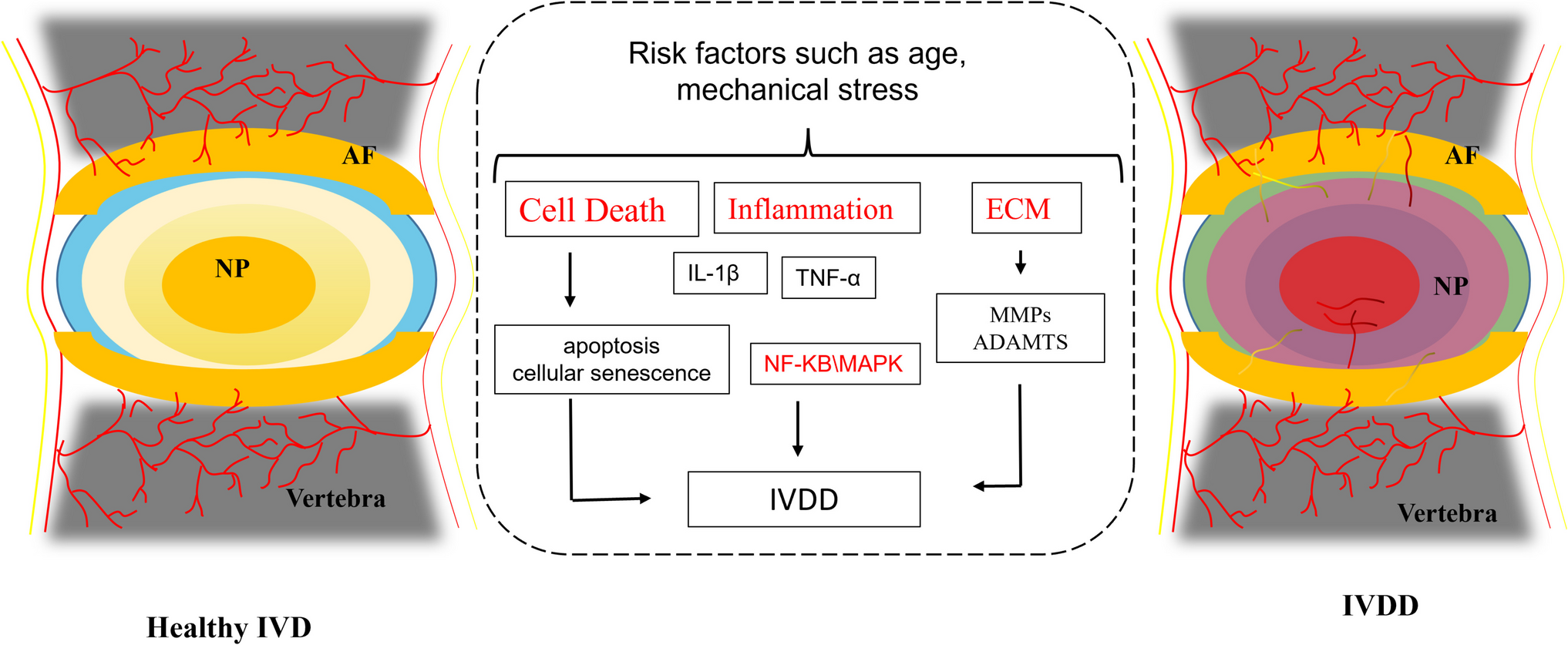 Molecular mechanisms and treatment strategies for discogenic lumbar pain