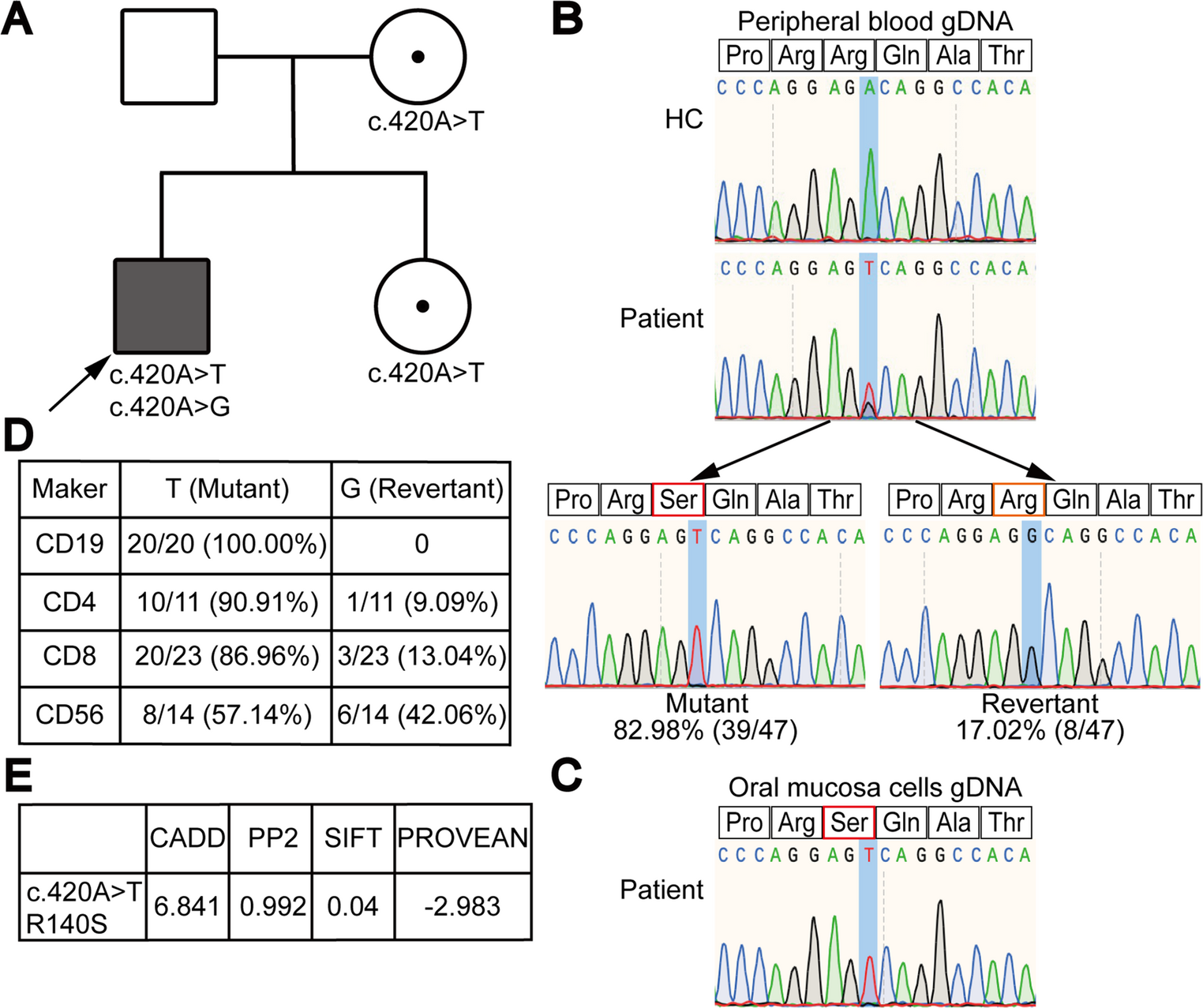 A Novel R140S γc Variant Alters Cellular Distribution, Reduces Surface Expression, and Impairs Cytokine Signaling in Atypical X-SCID