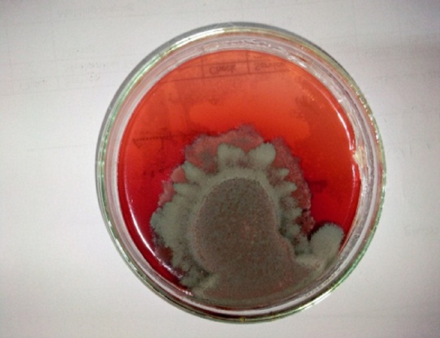 Mycofabrication of sustainable mycelium-based leather using Talaromyces sp. and irradiated eggplant peel waste