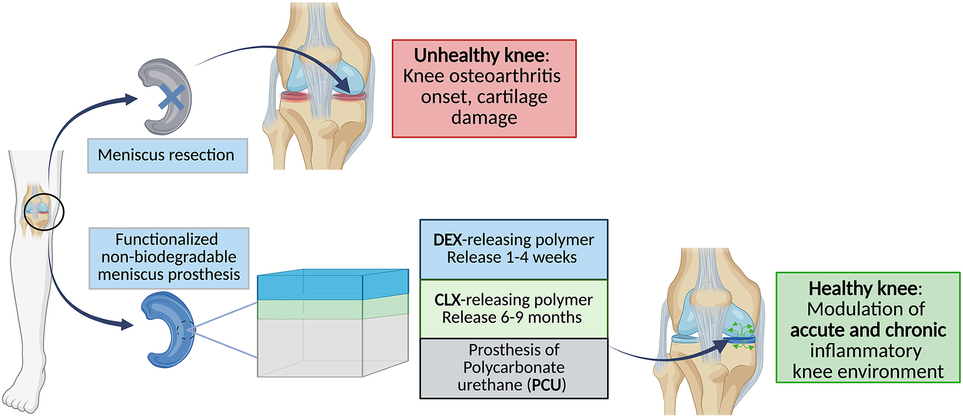 Controlled co-delivery of anti-inflammatory drugs from bilayer polymer films coating a meniscus implant