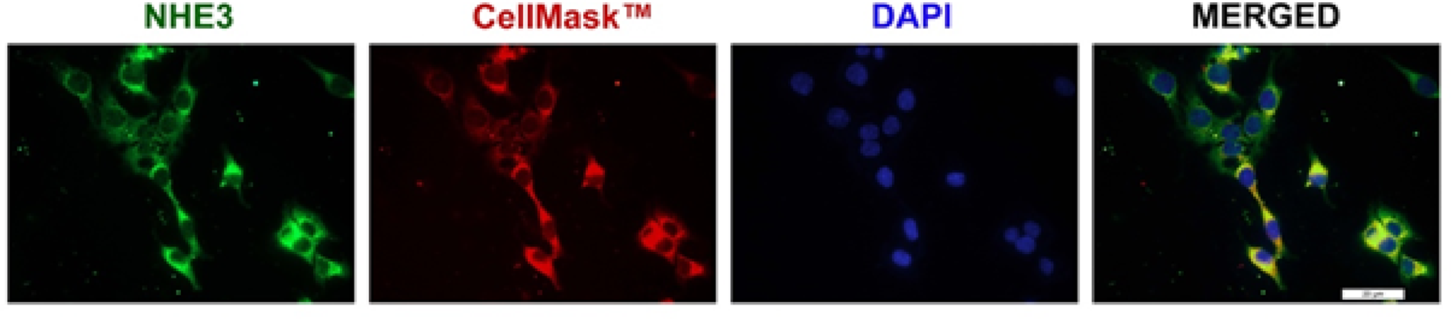 Histamine regulates the activity and the expression of the Na/H exchanger (NHE)3 in human epithelial HK-2 cells