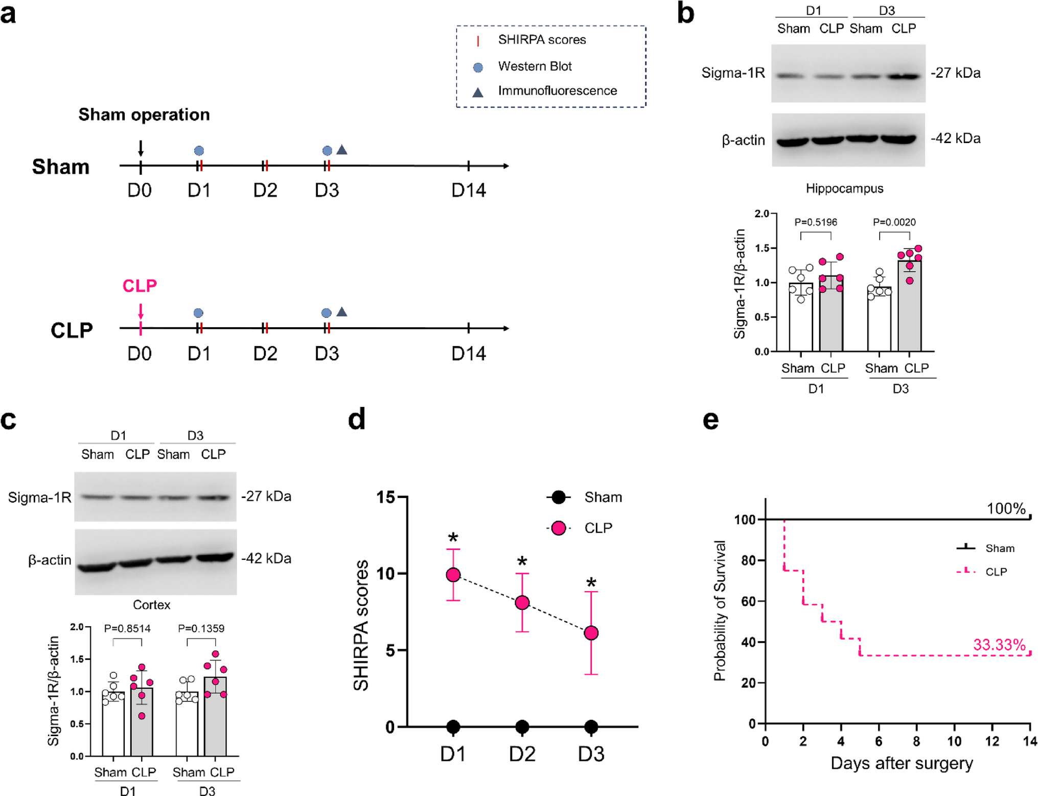 Sigma-1 receptor activation by PRE-084 attenuates sepsis-associated encephalopathy by targeting microglial p38 MAPK-mediated neuroinflammation and neuronal endoplasmic reticulum stress