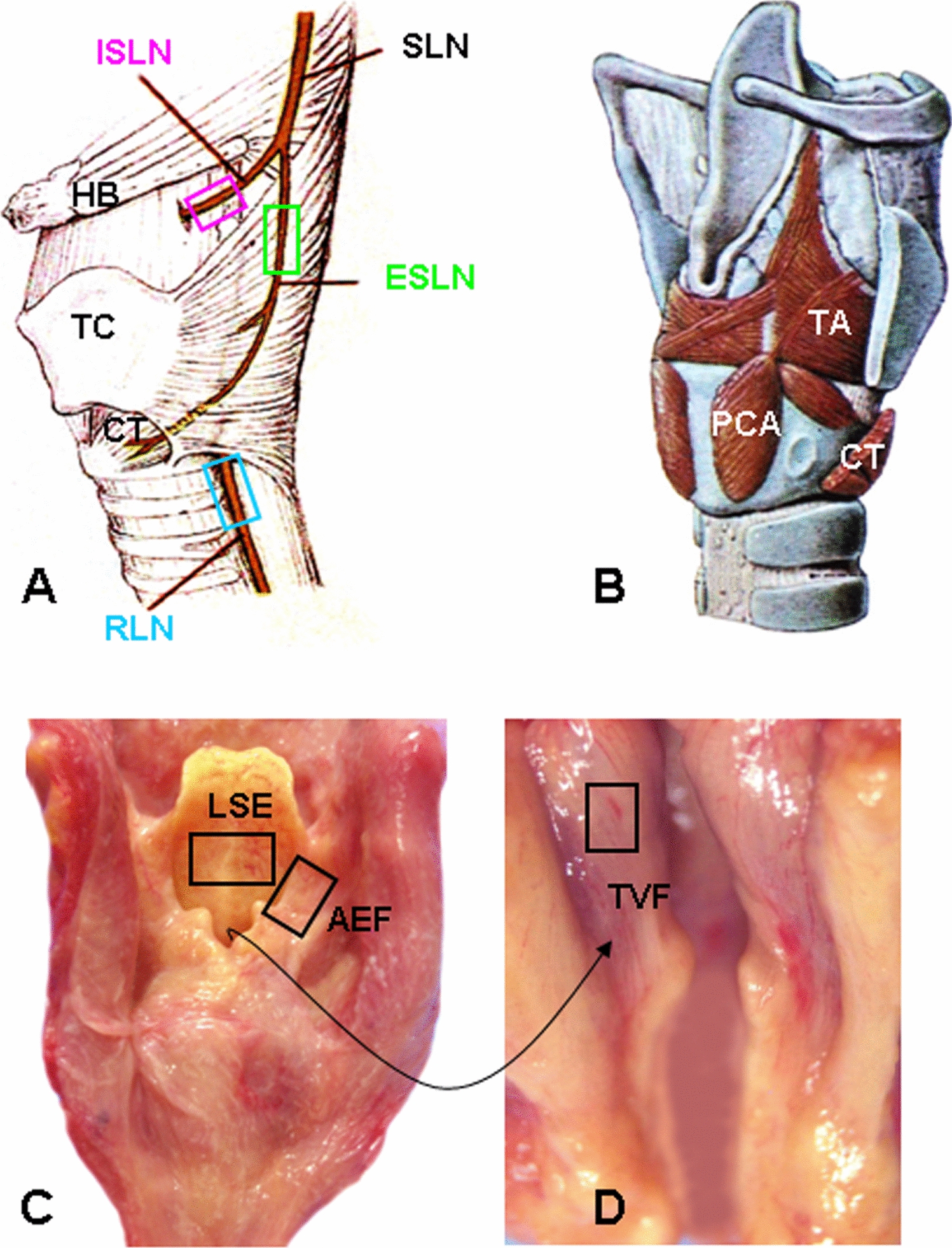 Alpha-Synuclein Lesions in the Peripheral Nervous System of the Larynx in Parkinson’s Disease