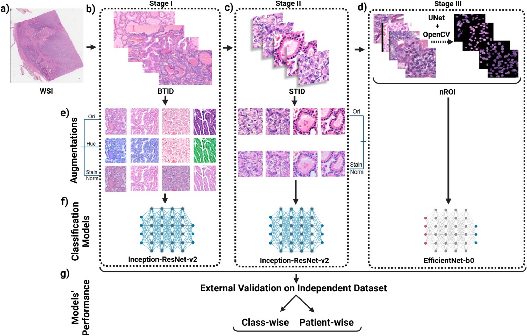A Novel Three-Stage AI-Assisted Approach for Accurate Differential Diagnosis and Classification of NIFTP and Thyroid Neoplasms