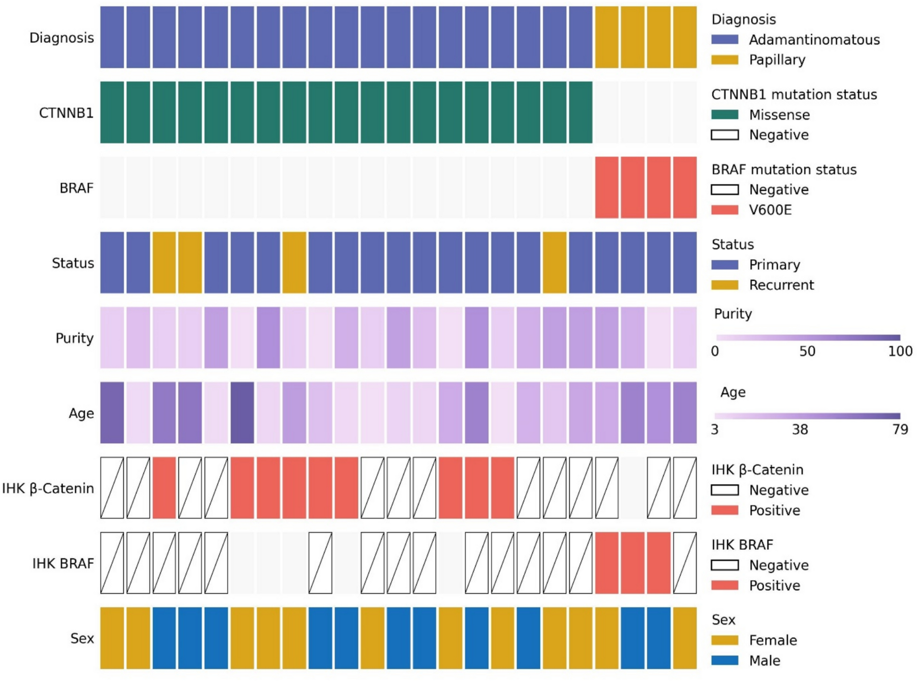 Comprehensive molecular characterization of craniopharyngiomas using whole transcriptome and spatial transcriptomics approaches