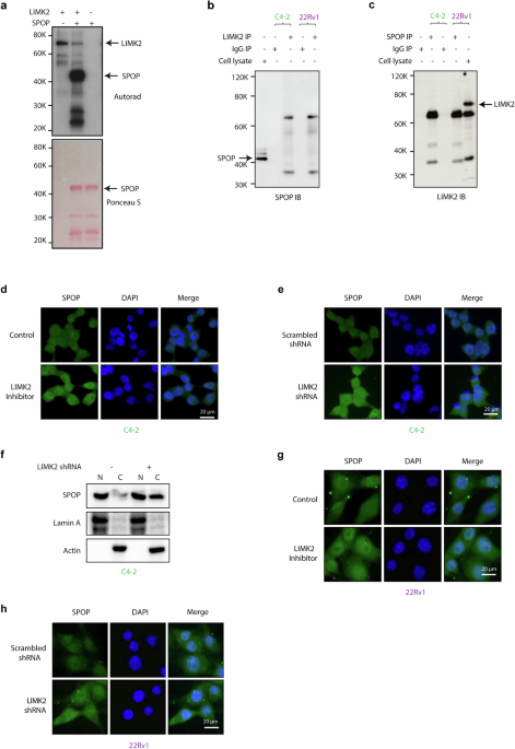 Correction: Phosphorylation-dependent regulation of SPOP by LIMK2 promotes castration-resistant prostate cancer