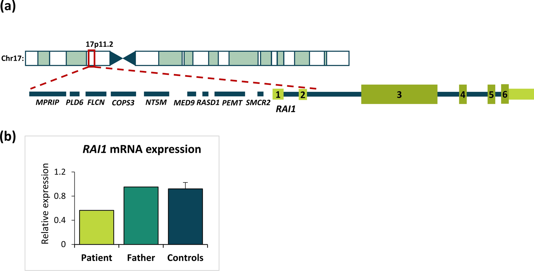 Deletion of  noncoding exons 1–2 causes Smith–Magenis syndrome