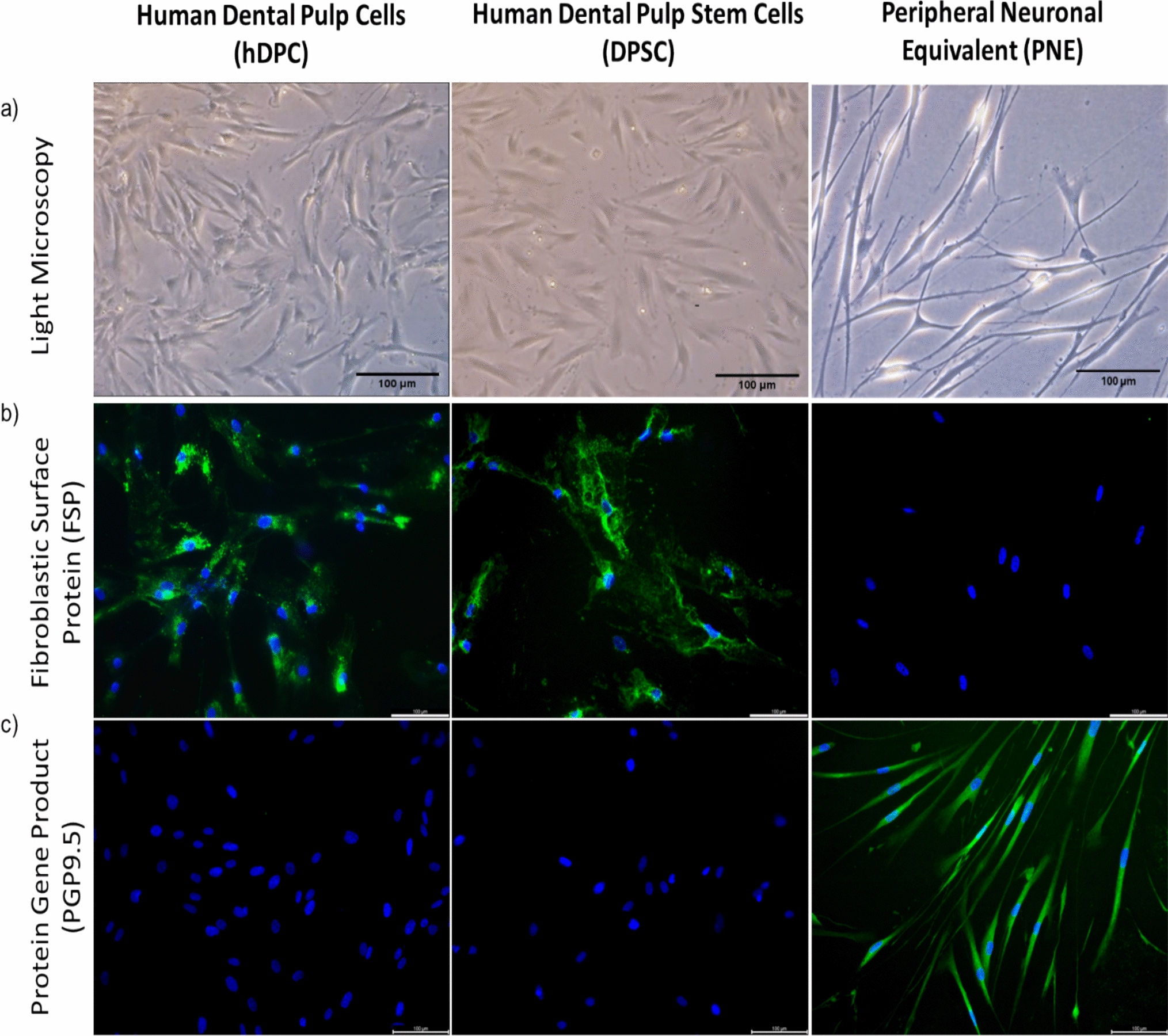 Neuroinflammatory Consequences of Rhinovirus Infection in Human Epithelial and Neuronal Models