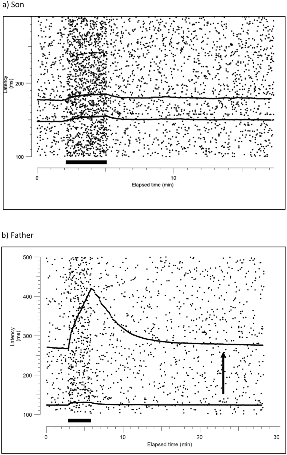 Unnerving Cough in CANVAS: Cough Hypersensitivity Despite Airway Nerve Depletion