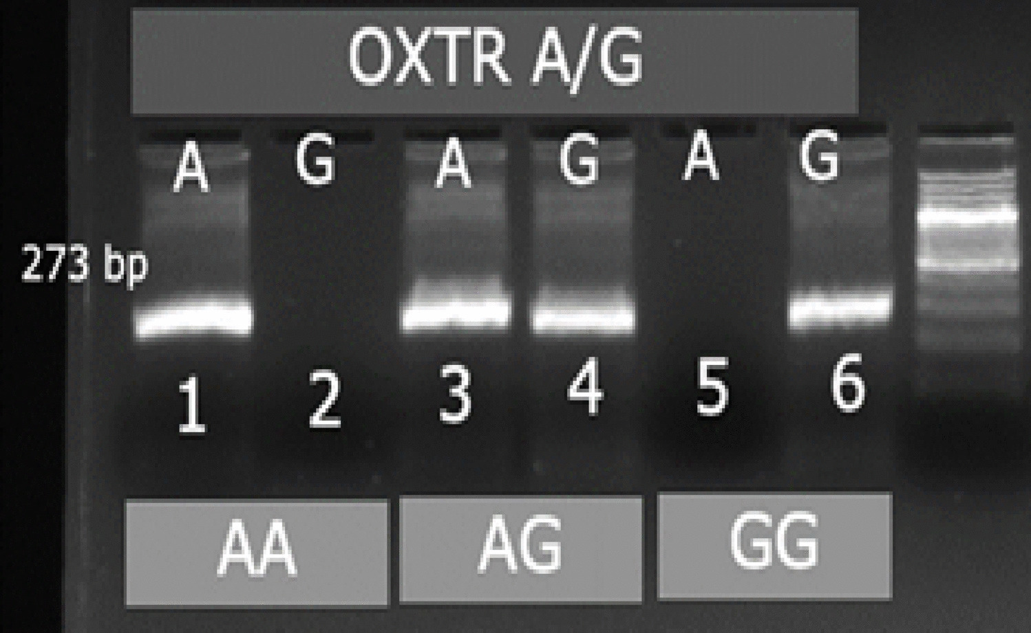 Investigating the Genetic Diversity of DRD2 and OXTR Genes in the Iranian Population and Its Relationship with Personality Traits