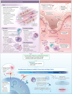 The Evolving Challenge of Infections in Cirrhosis