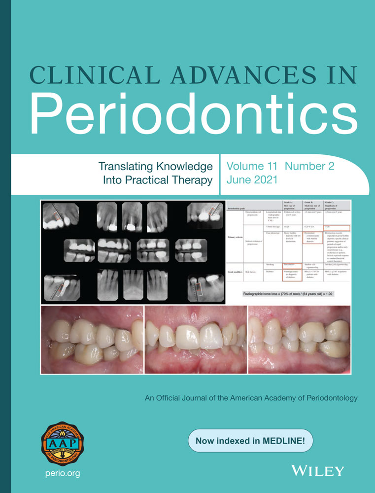 The Multiple Pedicle Coronally Advanced Flap for Multiple Deep Miller‐class‐II‐recessions: A Case Report