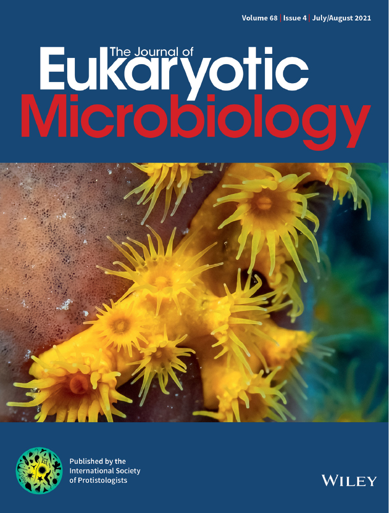 Photosystem I P700 Chlorophyll a Apoprotein A1 as PCR Marker to Identify Diatoms and their Associated Lineage