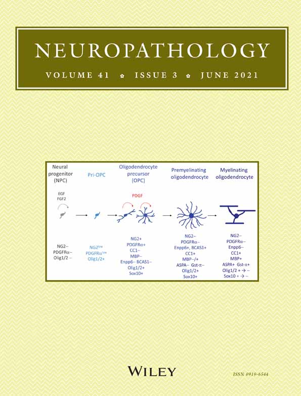 The hot cross bun sign in corticobasal degeneration