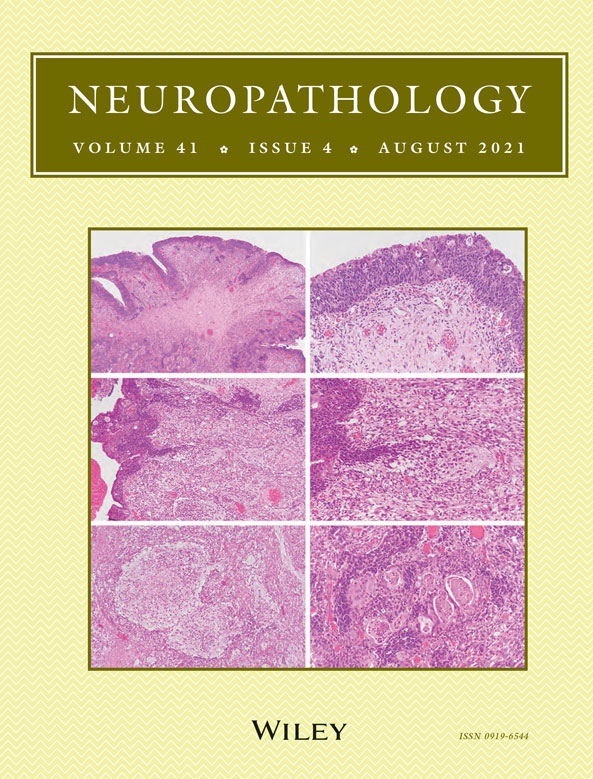 Intraventricular mucin‐producing glioblastoma arising in the septum pellucidum at the frontal horn of the lateral ventricle: A case report