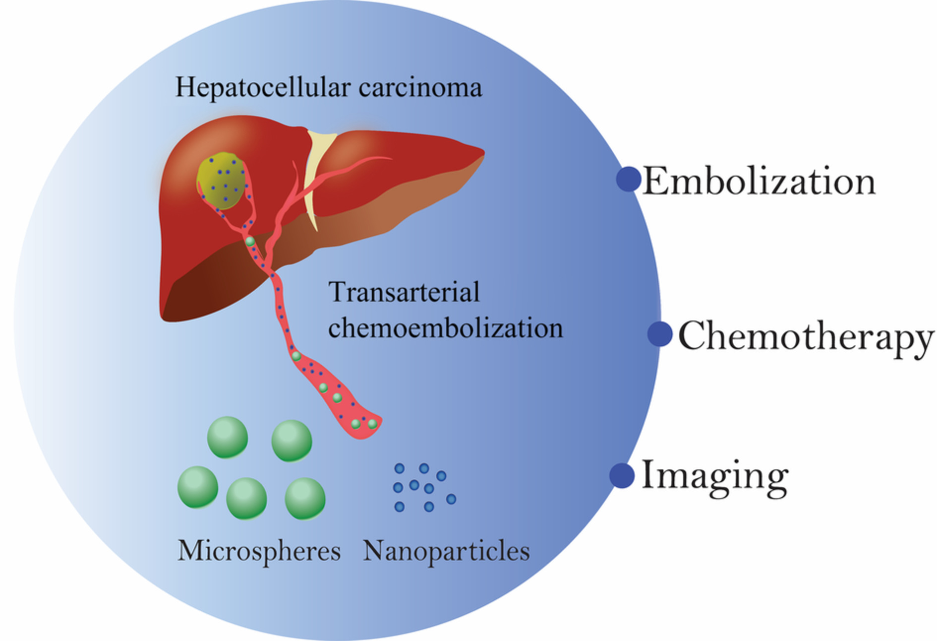 Recent advances and applications of microspheres and nanoparticles in transarterial chemoembolization for hepatocellular carcinoma