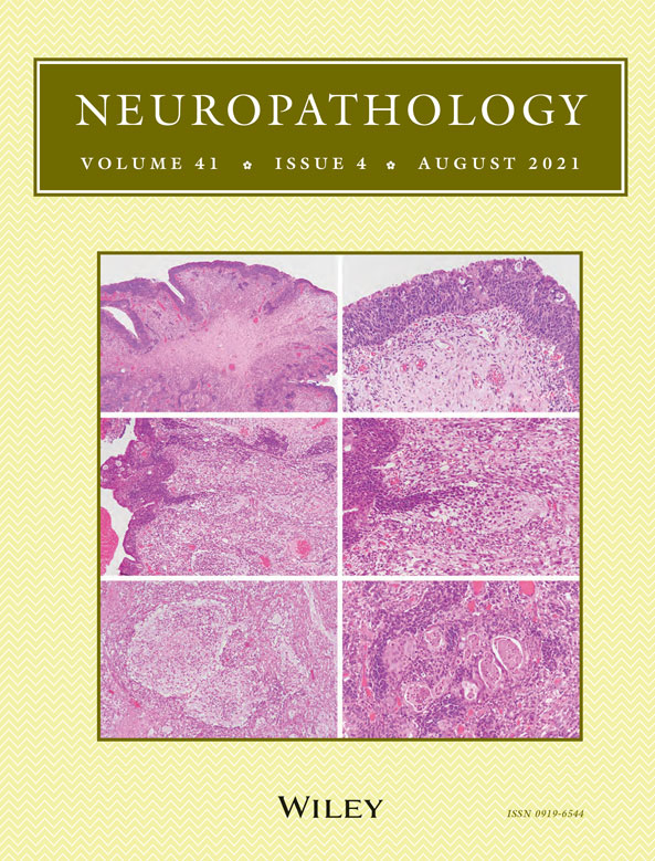 Senile plaque calcification of the lamina circumvoluta medullaris in Alzheimer's disease