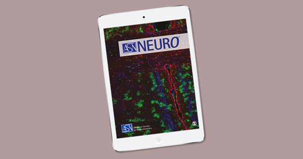 Nitric Oxide Induces a Janus Kinase-1-Dependent Inflammatory Response in Primary Murine Astrocytes