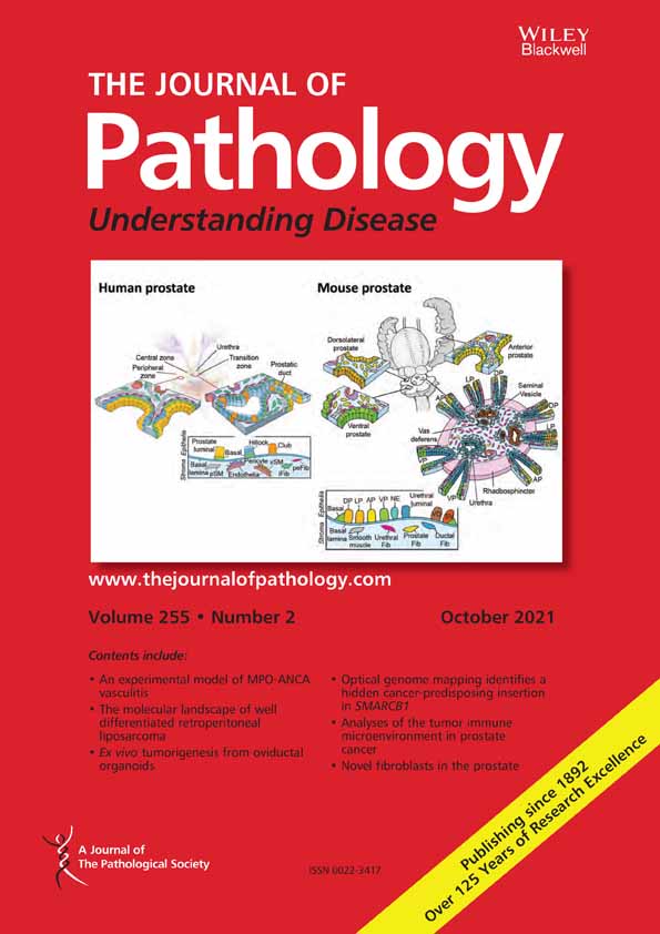 Tubule‐derived INHBB promotes interstitial fibroblast activation and renal fibrosis