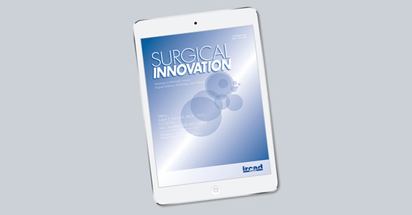 Three-Dimensional Computed Tomography Bronchography and Angiography-Guided Thoracoscopic Segmentectomy for Pulmonary Nodules