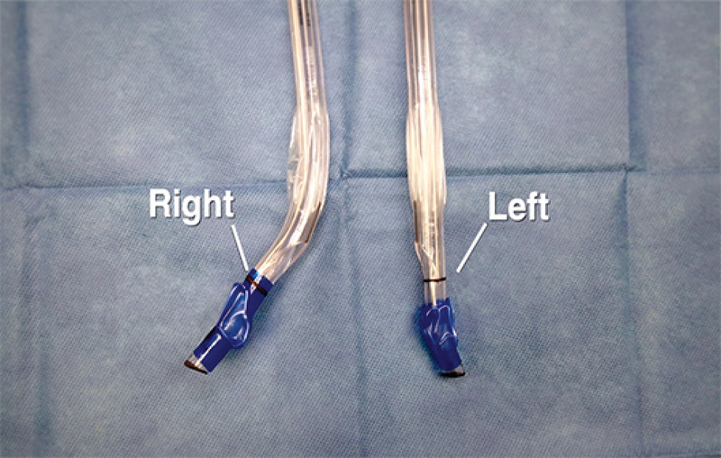 Placement of a Double-Lumen Endotracheal Tube