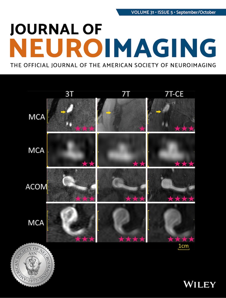 Leptomeningeal collateral flow in patients with middle cerebral artery occlusion assessed by transcranial Doppler