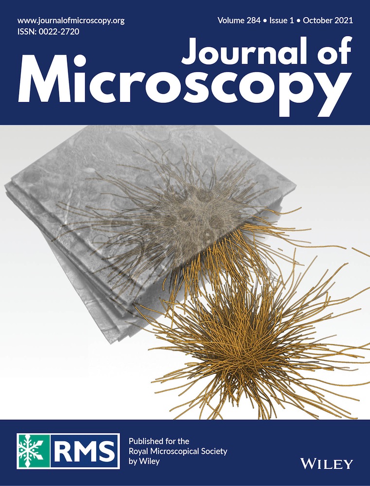 A case study of distress mechanism(s) in a concrete structure foundation in the saturated zone and above the saturated zone