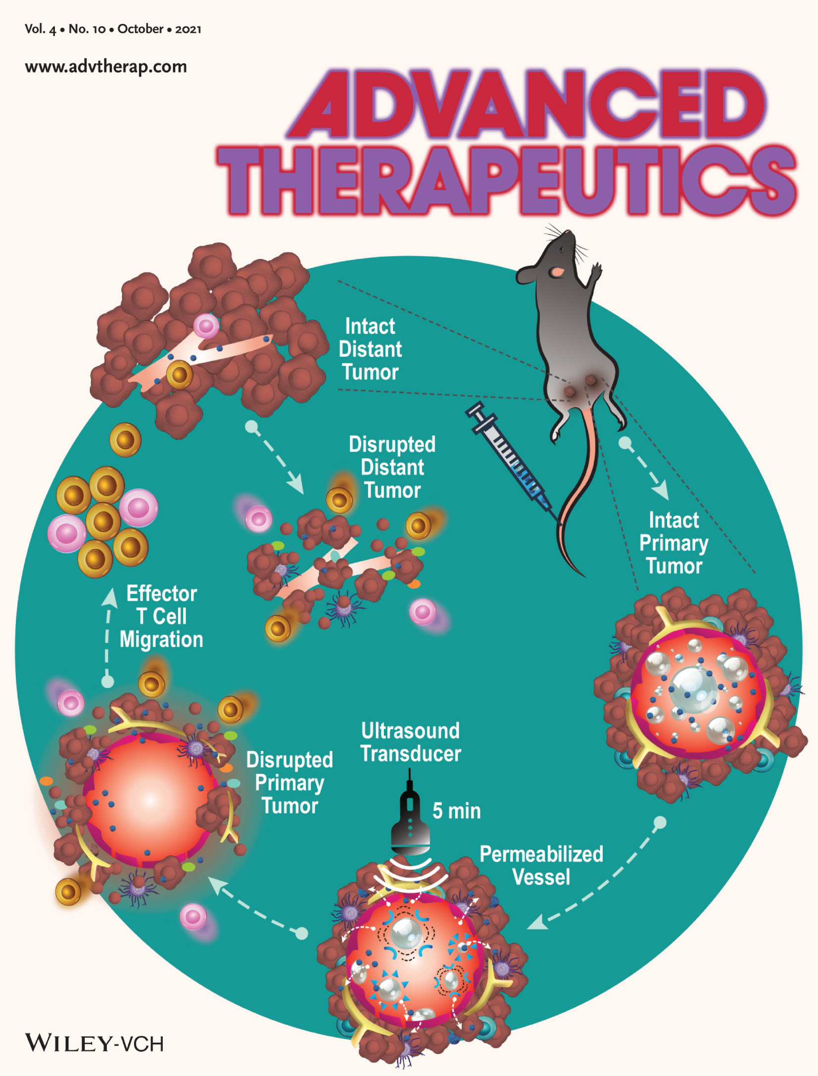 Sonoporation‐Enhanced Delivery of STING Agonist Induced Robust Immune Modulation and Tumor Regression (Adv. Therap. 10/2021)